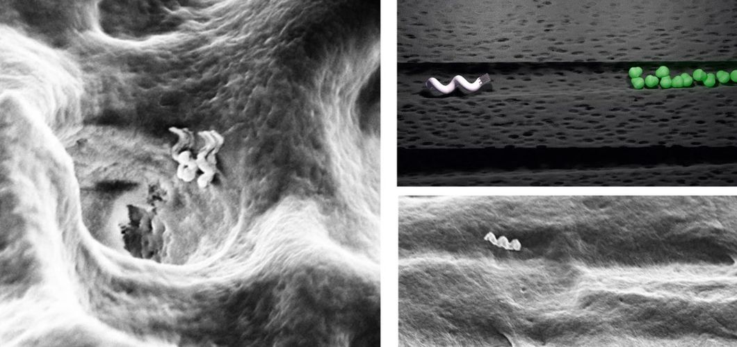 Nanoroboti u zubnim kanalima čiste bakterije