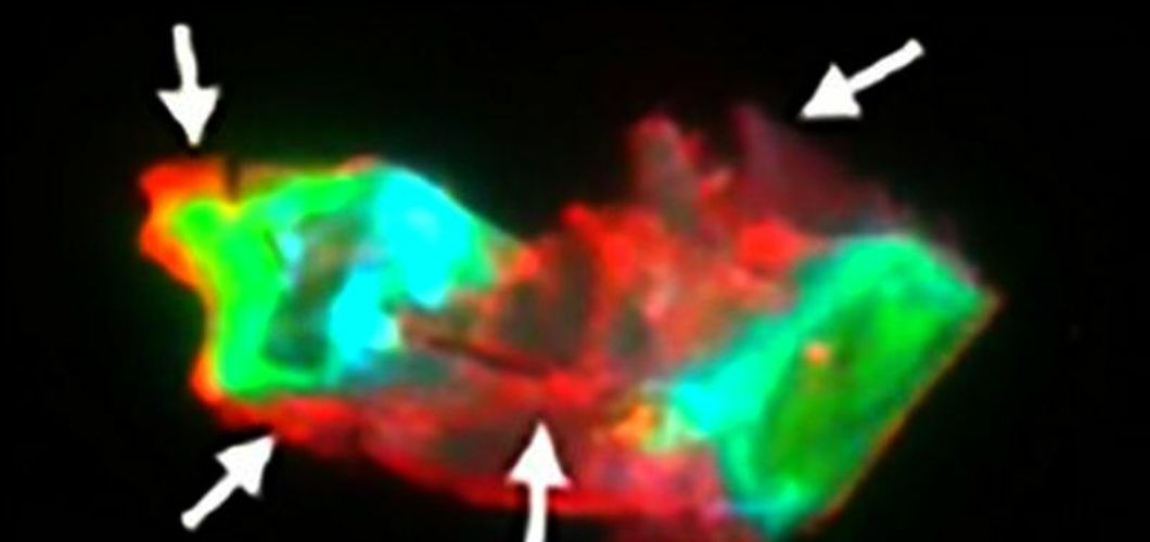 Mikrougrušak u krvi