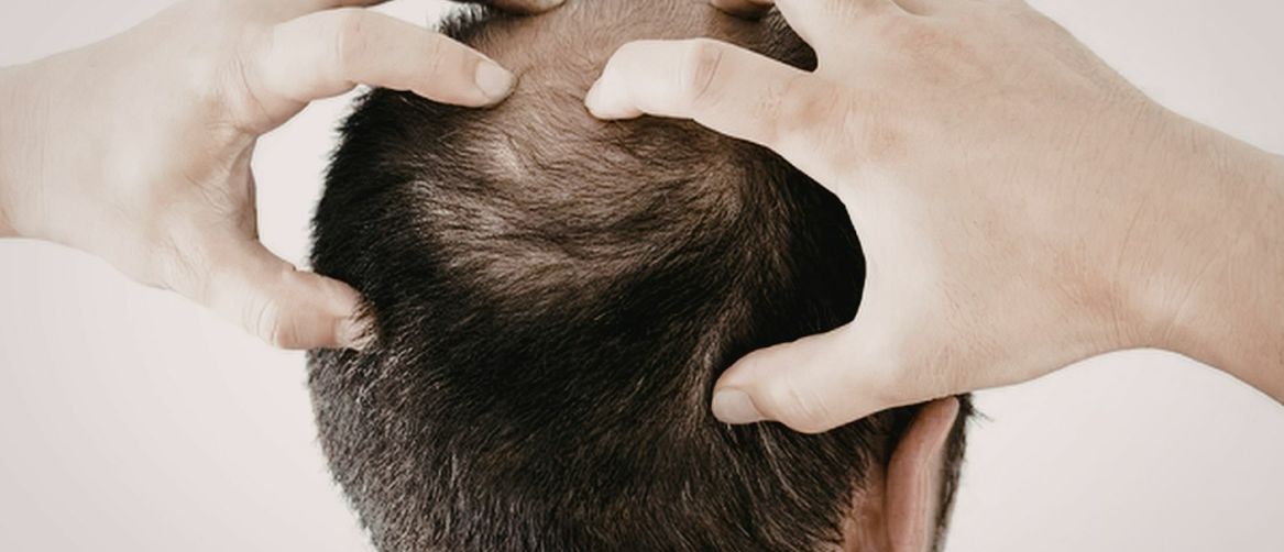 Ćelavi muškarac s rukama na glavi