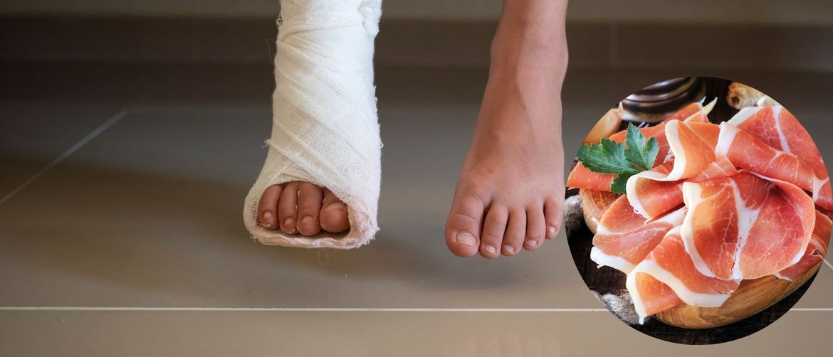 Tvrdi da se poskliznula na komad pršuta na podu