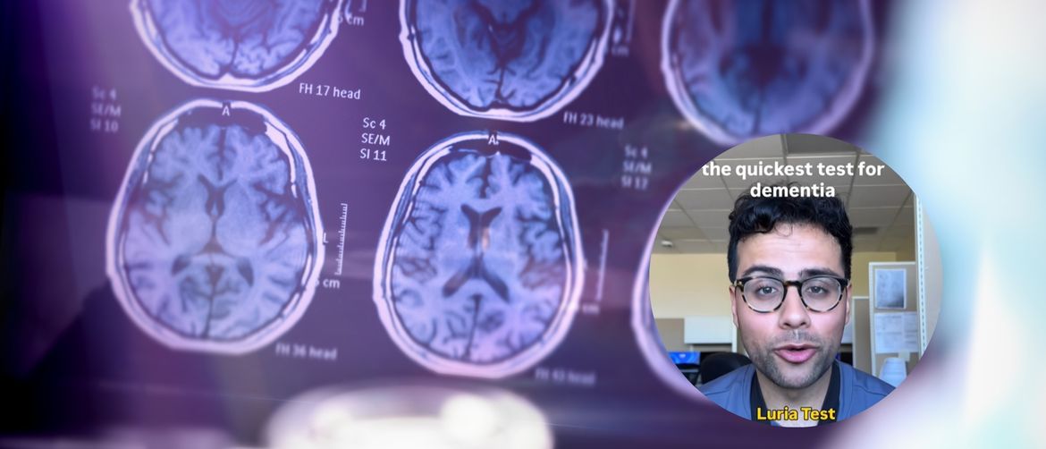 Snimke mozga i neurolog koji objašnjava test za demenciju