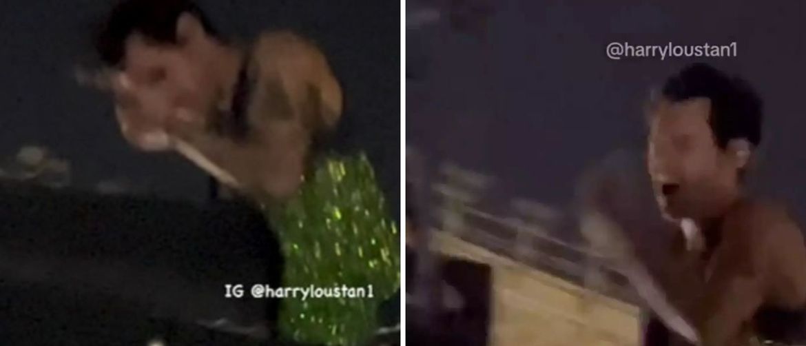 Harry Styles pogođen u lice na nastupu