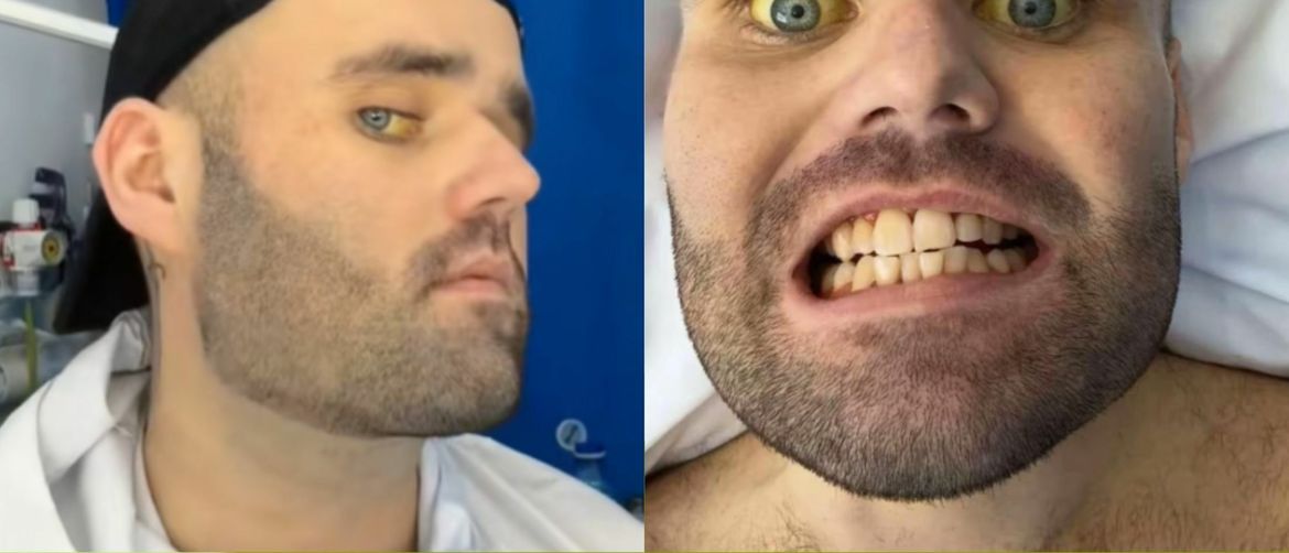 Sean Holland i njegovi simptomi alkoholizma