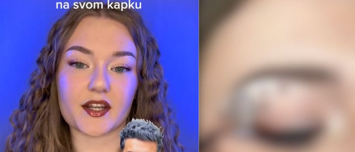 Baby Lasagna kao šminka