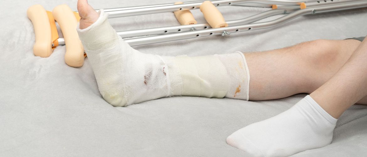 Noga u gipsu i štake pored osobe koja leži na krevetu