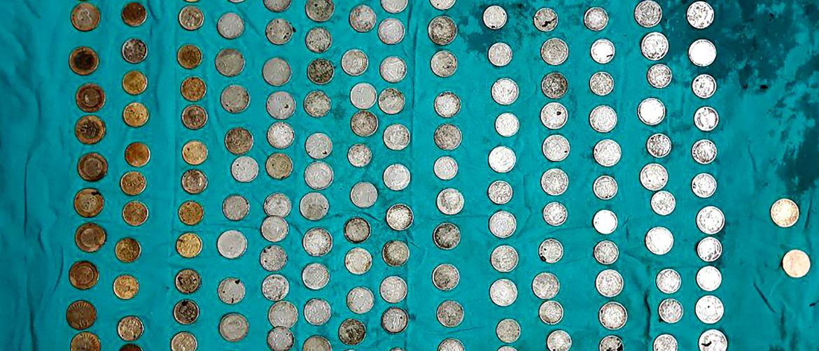 Liječnici su iz želuca izvadili 263 kovanice (FOTO: Profimedia)