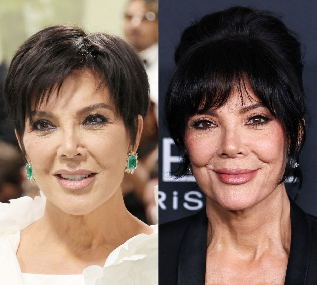 Kris Jenner prije i poslije zatezanja lica