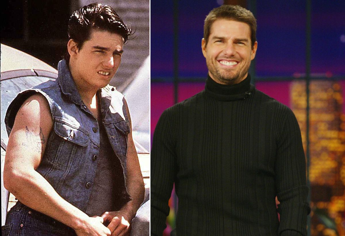 Slavni muškarci prije i nakon što su sredili zube - 2