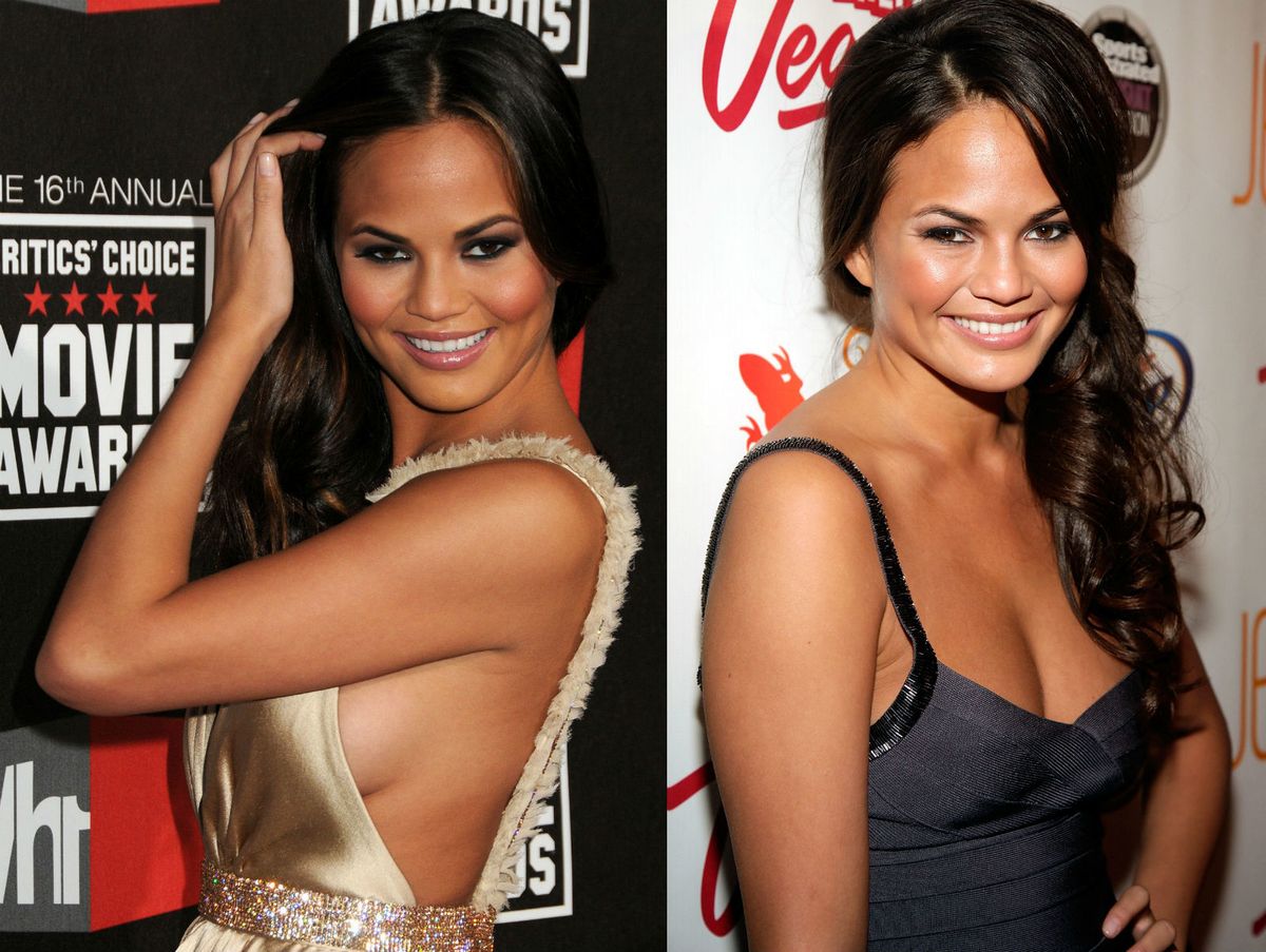 Slavne dame koje su priznale plastične operacije - 1