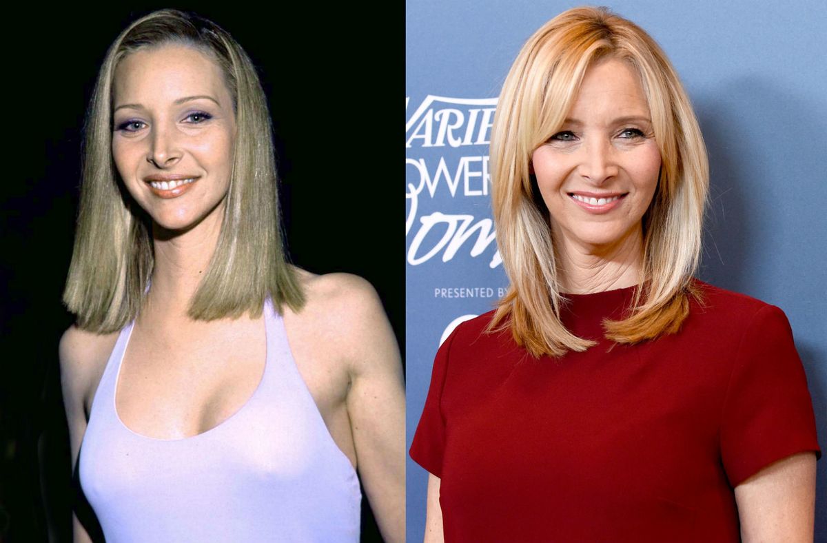 Slavne dame koje su priznale plastične operacije - 3