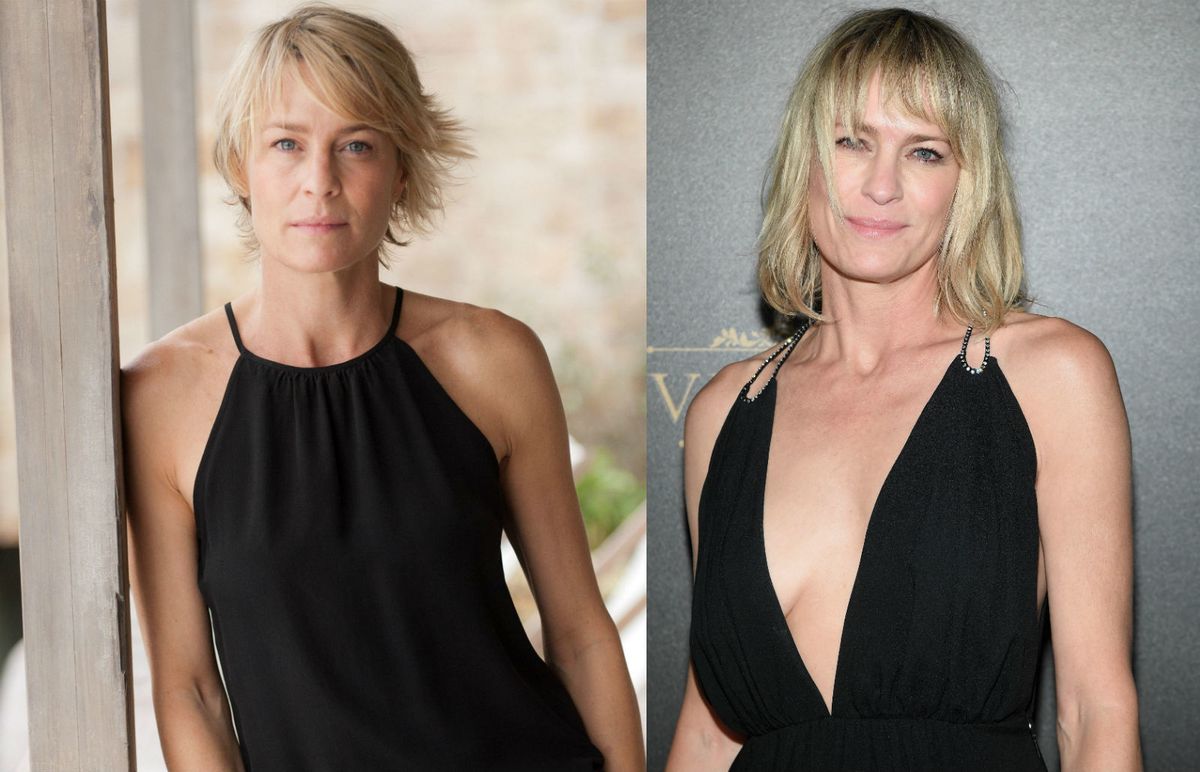 Slavne dame koje su priznale plastične operacije - 4