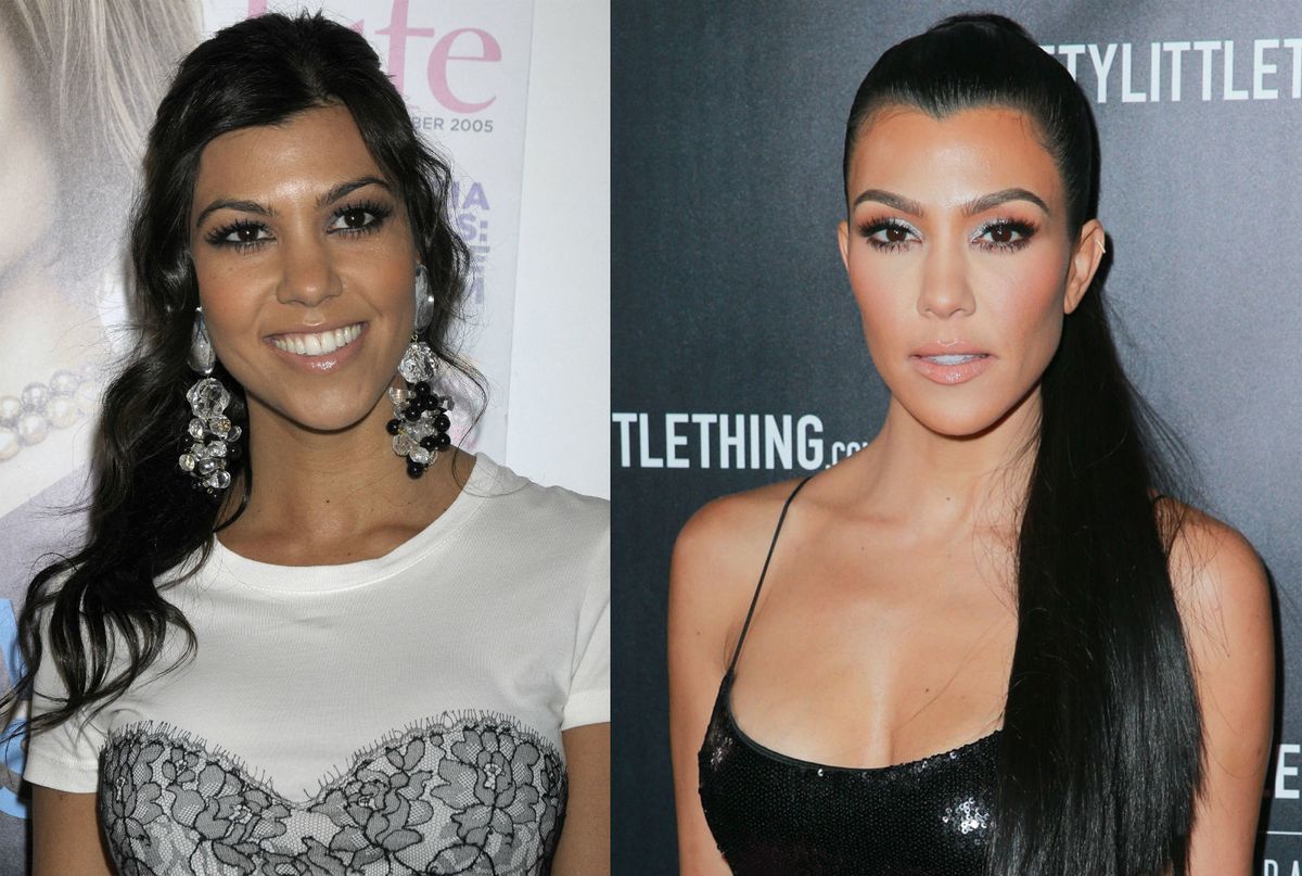 Slavne dame koje su priznale plastične operacije - 5