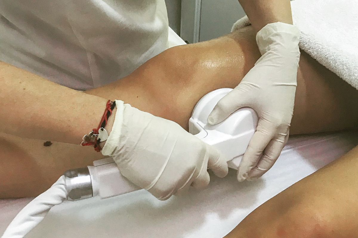 Coaxmed - revolucionaran uređaj u rješavanju celulita - 7