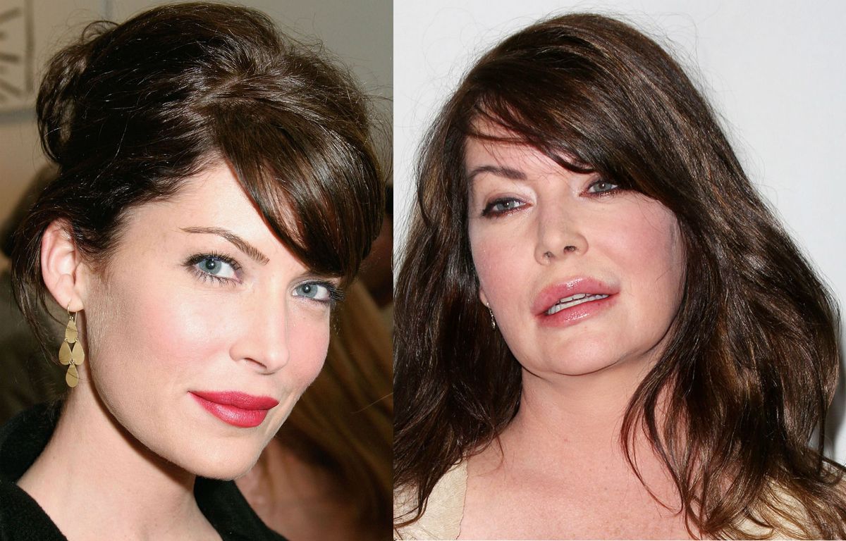 Slavne žene koje su bile ljepše prije plastične kirurgije - 1