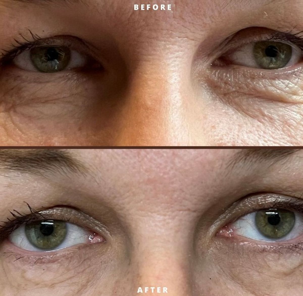 Zadovoljna recenzije: Čitateljice su isprobale kremu za instant korekciju vrećica ispod očiju