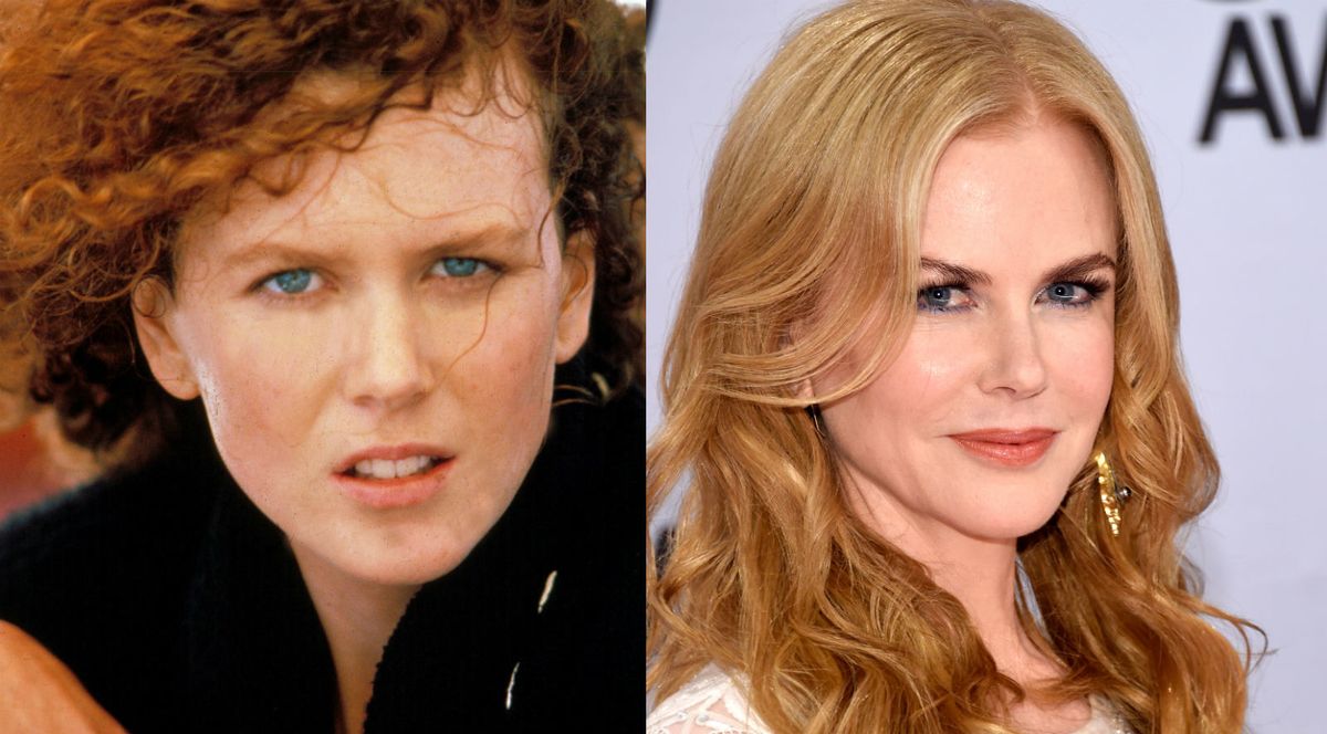 Nekad i sad: Slavne žene koje su povećale usne - 7