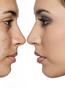 Lice žene prije i poslije nanošenja tekućeg pudera