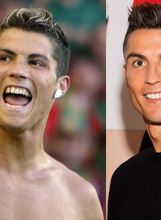 Cristiano Ronaldo prije i nakon što je sredio zube