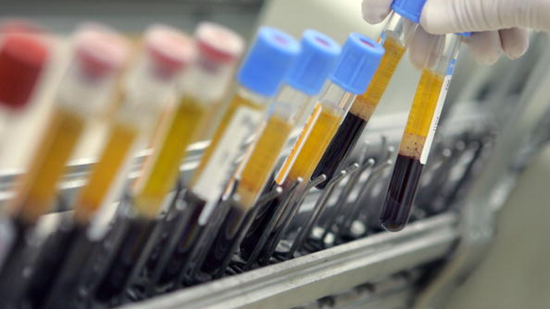 Liječnik podmetnuo svoje uzorke krvi i urina da izvuče brata koji je