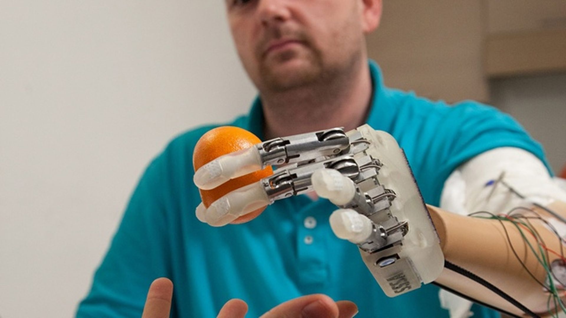 Искусственно созданная жизнь. Датчанину Деннису Аабо.. Бионический протез руки Джона Хопкинса. Touch Bionics протез кисти. Open Bionics протезы.