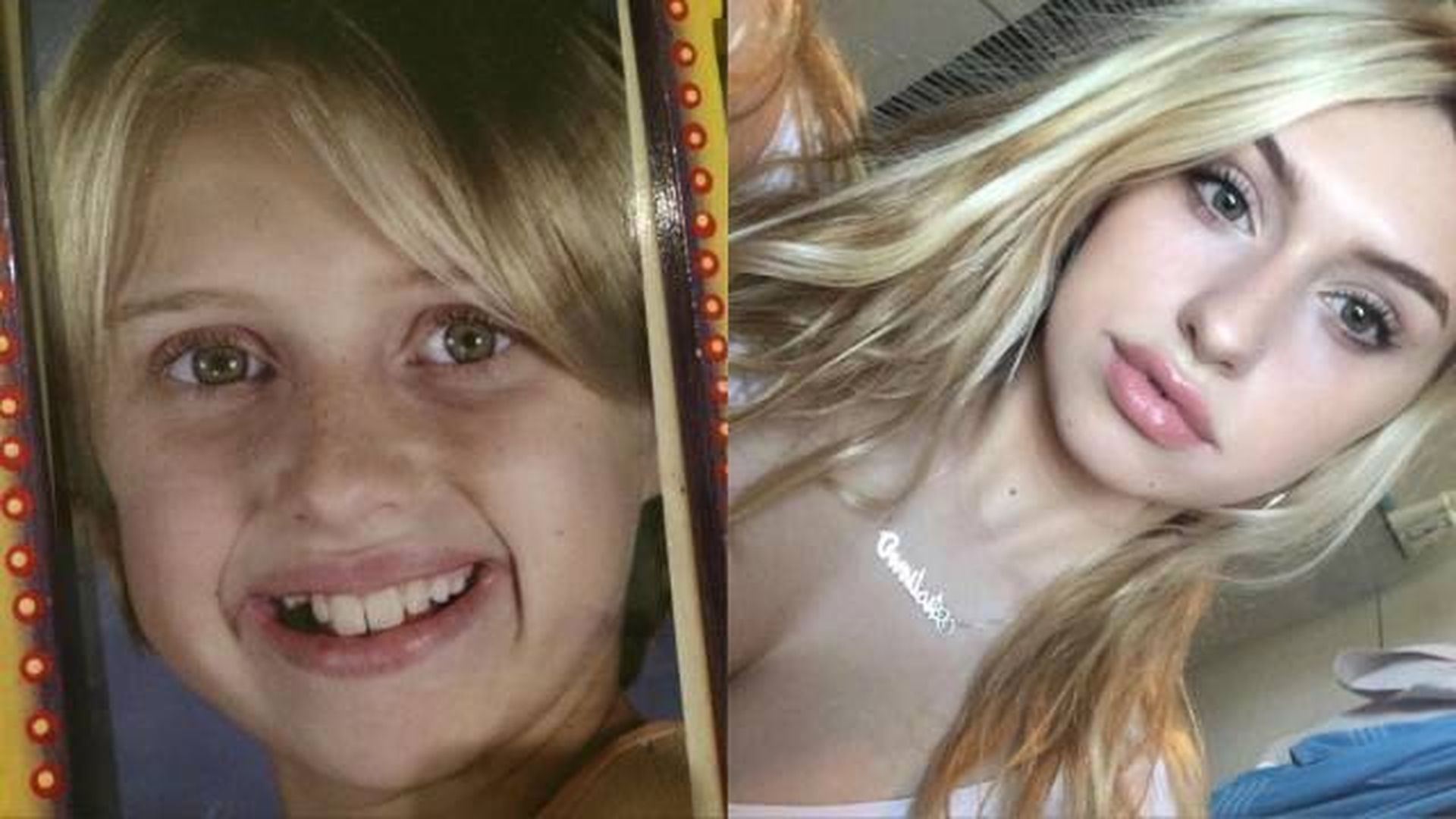 За несколько лет превратилась. Девочка лет 16 до и после. Дети которые изменились до неузнаваемости. За несколько лет превратилась. Люди которые внешне не очень.