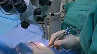 Prva transplantacija rožnice u KBC-u Split - 2
