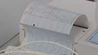 EKG, ilustracija