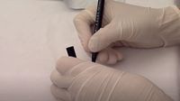 Hepatitis - Tihi ubojica - 4