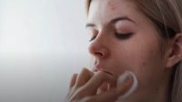Maske: Novo normalno, novi problemi - 5