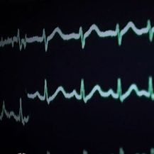 Provjereno: Problemi s uzdrmanim zdravstvenim sustavom - 3
