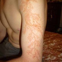 Udar groma (Foto: Imgur) - 6