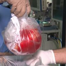 Transplantacija srca