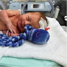 Opća bolnica Virovitica je među prvima u Hrvatskoj koja bebama nudi hobotnicu za smirenje i utjehu
