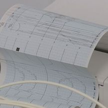 EKG, ilustracija