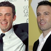 Slavni muškarci prije i nakon što su sredili zube - 1