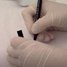 Hepatitis - Tihi ubojica - 4