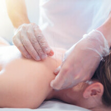 Akupunktura kao sredstvo ublažvanja simptoma (peri)menopauze