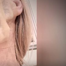 Provjereno: posljedice estetskih operacija - 3