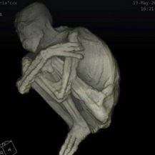 Izvanzemaljska mumija s tri prsta ima isti broj kromosoma kao ljudi, ali ne i anatomiju (Screenshot YouTube)