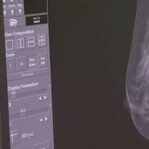 Tjedan ženskog zdravlja - budi sebi prva (Foto: Dnevnik.hr) - 2