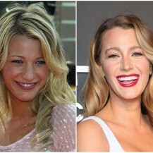 Blake Lively