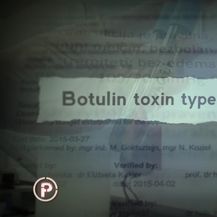 Provjereno istražuje injekcije botoksa (Foto: Provjereno) - 20