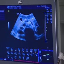 Snimka ultrazvuka (Foto: Dnevnik.hr)