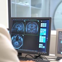 Magnetska rezonanca pruža najkvalitetniju dijagnostiku