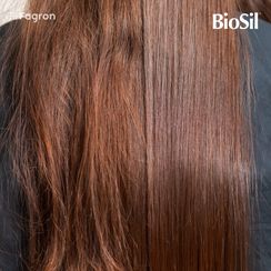 Biosil kapsule