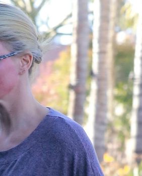 Slavne žene koje je dobar ten \'iznevjerio\' - 3