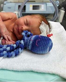 Opća bolnica Virovitica je među prvima u Hrvatskoj koja bebama nudi hobotnicu za smirenje i utjehu