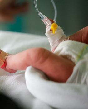 Prijevremeno rođena beba