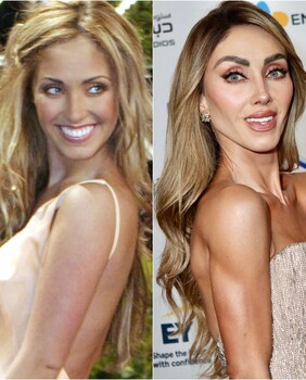 Anahi