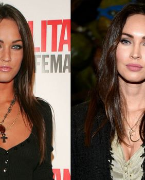 Nekad i sad: Slavne žene koje su povećale usne - 1